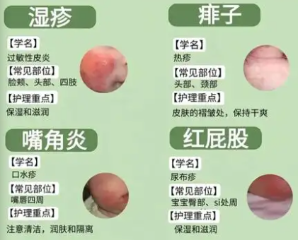 拍一拍识别皮肤病
