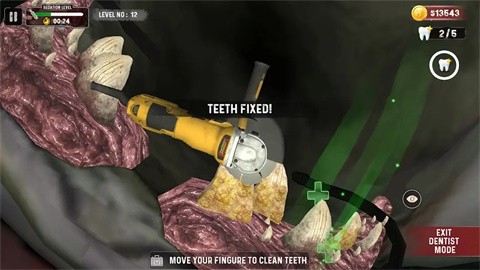 鲨鱼牙医模拟器截图